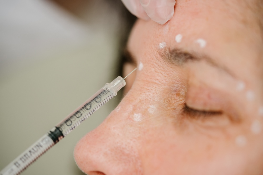 aesthetische-medizin-stuttgart-LEX01632